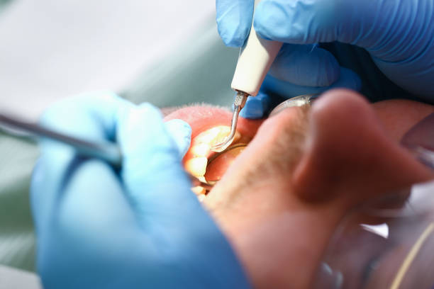 Best Emergency Dental Care for Broken or Chipped Teeth in Oak Grove Heights, AR